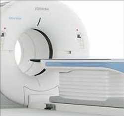 Mercado mundial de escáneres de tomografía computarizada