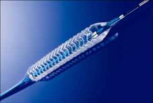 Global Stents bioabsorbibles Tamaño de mercado