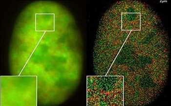 Global Microscopía de imágenes de fluorescencia de por vida Oportunidades de mercado