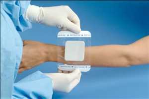 Global-Advanced-Wound-Care-Market