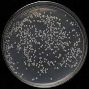 Global-Agrobacterium-Tumefaciens-Competent-Cells-Market