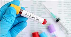 Global-Albumin-Market