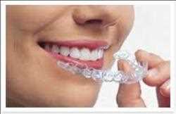 Global-Dental-Braces-Market