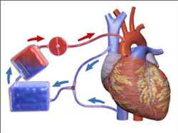 Demanda del mercado mundial de máquinas de corazón y pulmón artificiales