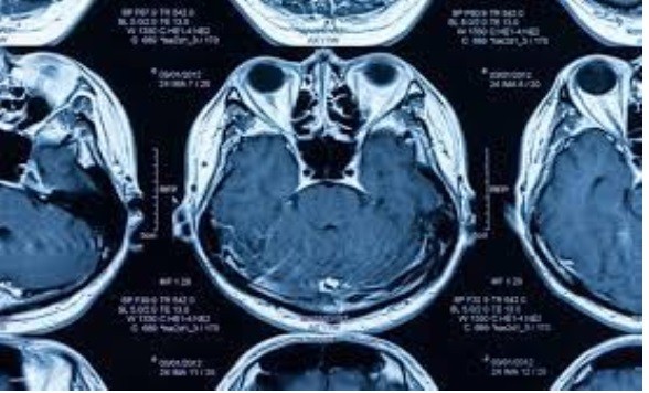 Agentes de medios de contraste para resonancia magnética Mercado