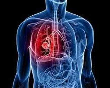 Diagnóstico respiratorio Mercado