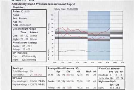 Monitores ambulatorios de presión arterial las 24 horas Mercado