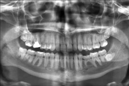 Radiografía Dental Mercado